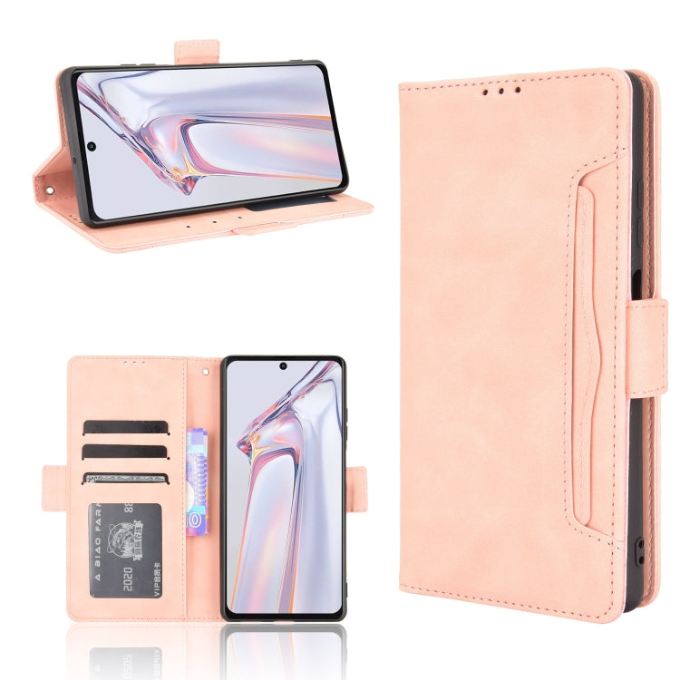 Skin Feel Calf Pattern Horizontal Flip Leather Case with Holder & Card Slots & Photo Frame, For Infinix Note 10, For Xiaomi Redmi Note 10 5G, For Xiaomi Redmi Note 10 JP Version, For Blackview A100