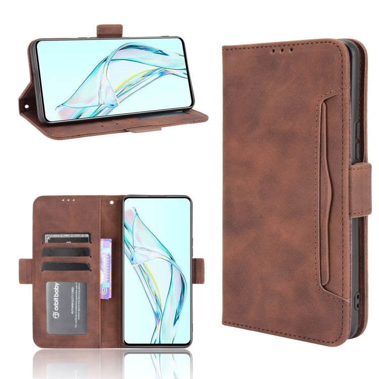 Skin Feel Calf Pattern Horizontal Flip Leather Case with Holder & Card Slots & Photo Frame, For Sony Xperia 10 III, For Xiaomi Mi Mix 4, For UMIDIGI Bison Pro, For ZTE Axon 30 5G