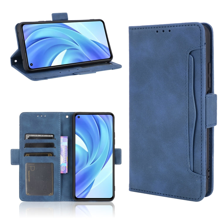 Skin Feel Calf Pattern Horizontal Flip Leather Case with Holder & Card Slots & Photo Frame, For Sony Xperia 1 III, For Sony Xperia 10  III, For Xiaomi Mi 10S, For Xiaomi Mi 11 Lite 4G / Mi 11 Lite 5G