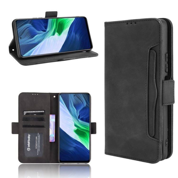 Skin Feel Calf Pattern Horizontal Flip Leather Case with Holder & Card Slots & Photo Frame, For Infinix Note 10, For Xiaomi Redmi Note 10 5G, For Xiaomi Redmi Note 10 JP Version, For Blackview A100