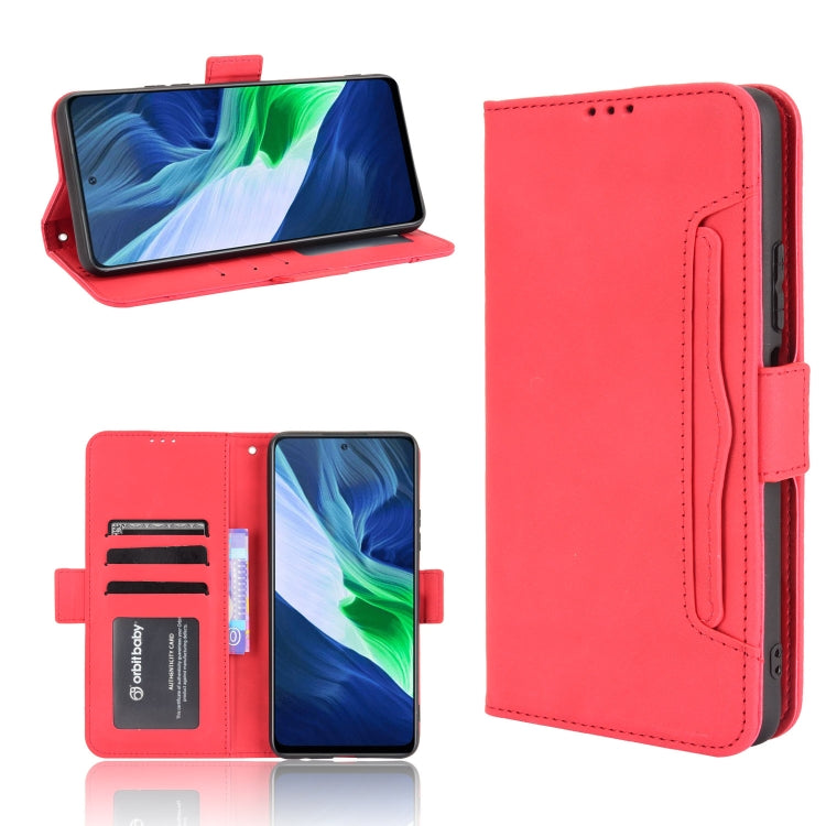 Skin Feel Calf Pattern Horizontal Flip Leather Case with Holder & Card Slots & Photo Frame, For Infinix Note 10, For Xiaomi Redmi Note 10 5G, For Xiaomi Redmi Note 10 JP Version, For Blackview A100