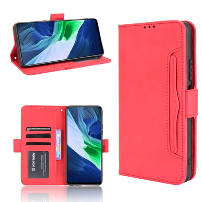 Skin Feel Calf Pattern Horizontal Flip Leather Case with Holder & Card Slots & Photo Frame, For Infinix Note 10, For Xiaomi Redmi Note 10 5G, For Xiaomi Redmi Note 10 JP Version, For Blackview A100