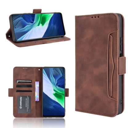 Skin Feel Calf Pattern Horizontal Flip Leather Case with Holder & Card Slots & Photo Frame, For Infinix Note 10, For Xiaomi Redmi Note 10 5G, For Xiaomi Redmi Note 10 JP Version, For Blackview A100