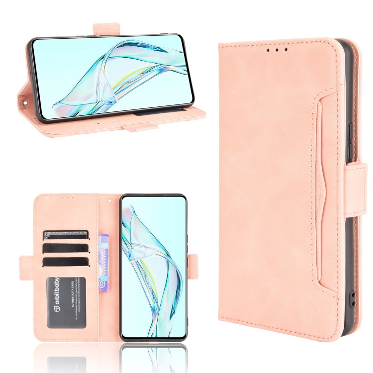 Skin Feel Calf Pattern Horizontal Flip Leather Case with Holder & Card Slots & Photo Frame, For Sony Xperia 10 III, For Xiaomi Mi Mix 4, For UMIDIGI Bison Pro, For ZTE Axon 30 5G