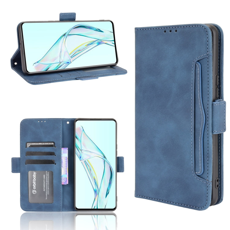 Skin Feel Calf Pattern Horizontal Flip Leather Case with Holder & Card Slots & Photo Frame, For Sony Xperia 10 III, For Xiaomi Mi Mix 4, For UMIDIGI Bison Pro, For ZTE Axon 30 5G