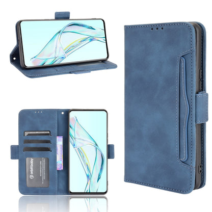 Skin Feel Calf Pattern Horizontal Flip Leather Case with Holder & Card Slots & Photo Frame, For Sony Xperia 10 III, For Xiaomi Mi Mix 4, For UMIDIGI Bison Pro, For ZTE Axon 30 5G