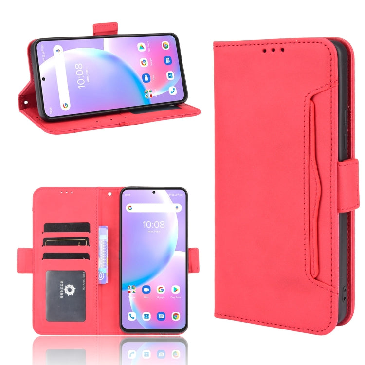 Skin Feel Calf Pattern Horizontal Flip Leather Case with Holder & Card Slots & Photo Frame, For Umidigi A11 Pro Max