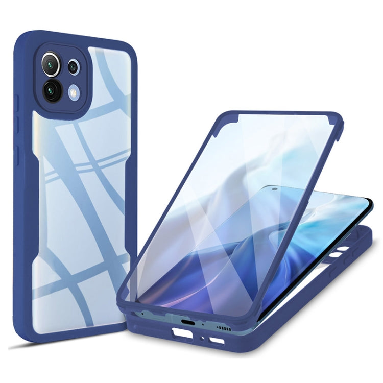 Acrylic + TPU 360 Degrees Full Coverage Shockproof Phone Case, For Xiaomi Mi 11, For Xiaomi Mi 11 Lite, For Xiaomi Mi 11T / 11T Pro, For Xiaomi Redmi Note 11 5G China