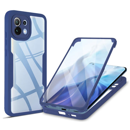 Acrylic + TPU 360 Degrees Full Coverage Shockproof Phone Case, For Xiaomi Mi 11, For Xiaomi Mi 11 Lite, For Xiaomi Mi 11T / 11T Pro, For Xiaomi Redmi Note 11 5G China