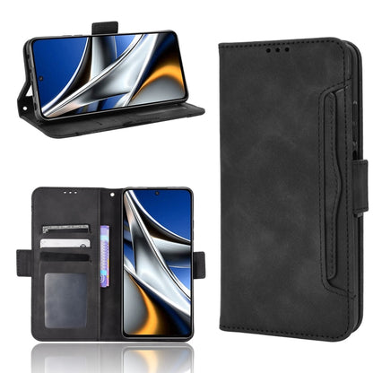 Skin Feel Calf Pattern Leather Phone Case, For Xiaomi Poco M4 Pro 5G, For OnePlus Nord CE 2 5G, For ZTE Blade A72