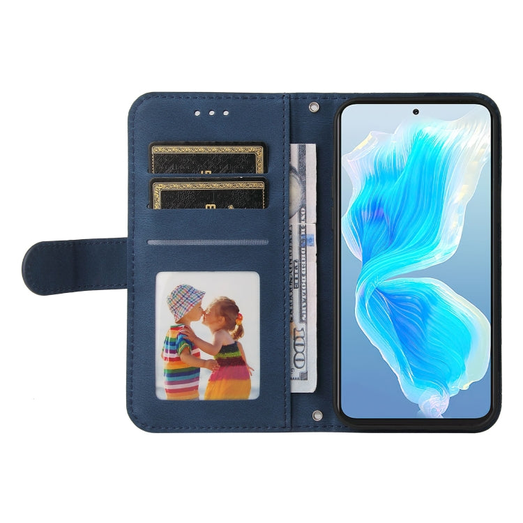 Skin Feel Life Tree Metal Button Leather Phone Case, For Tecno Camon 18 Premier, For Tecno Camon 18 / 18 Pro, For Infinix Hot 11s, For Infinix Hot 11s NFC