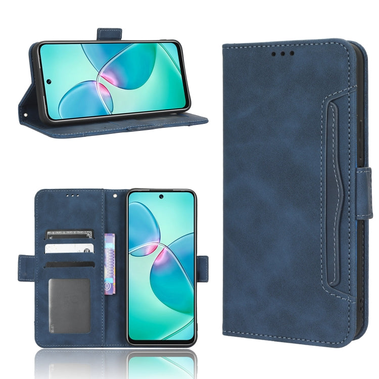 Skin Feel Calf Texture Card Slots Leather Phone Case, For vivo Y77 5G, For Infinix Note 12 G96, For Infinix Note 12 VIP, For Infinix Note 12i