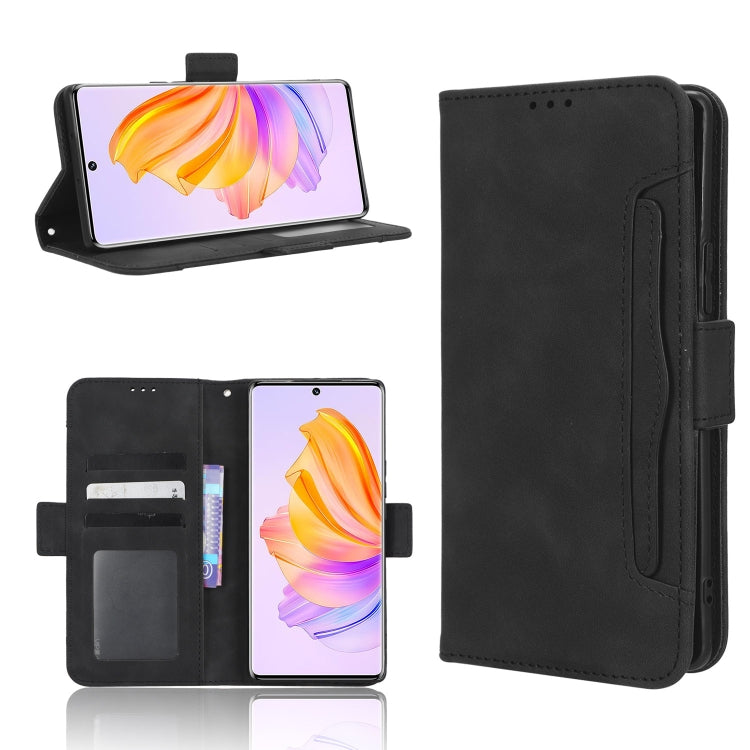 Skin Feel Calf Texture Card Slots Leather Phone Case, For Blackview BV5200, For Honor 80 SE 5G, For Honor 80 5G, For Honor 80 Pro 5G