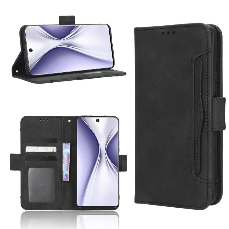 Skin Feel Calf Texture Card Slots Leather Phone Case, For Honor Play 6C / X8 5G / X6 4G, For Honor X20 SE / Huawei nova 10z, For Xiaomi 12T Pro, For Xiaomi Civi 2 5G / 12 Lite NE