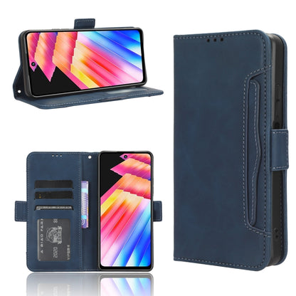 Skin Feel Calf Texture Card Slots Leather Phone Case, For Infinix Hot 30 4G X6831, For Infinix Hot 30 Play, For Infinix Hot 30i / 30i NFC, For Doogee X97 / X97 Pro