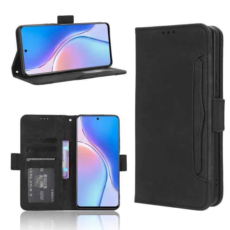 Skin Feel Calf Texture Card Slots Leather Phone Case, For Huawei P60 / P60 Pro, For Huawei Enjoy 60 4G, For Huawei Maimang 20, For Blackview A85