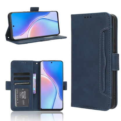 Skin Feel Calf Texture Card Slots Leather Phone Case, For Huawei P60 / P60 Pro, For Huawei Enjoy 60 4G, For Huawei Maimang 20, For Blackview A85