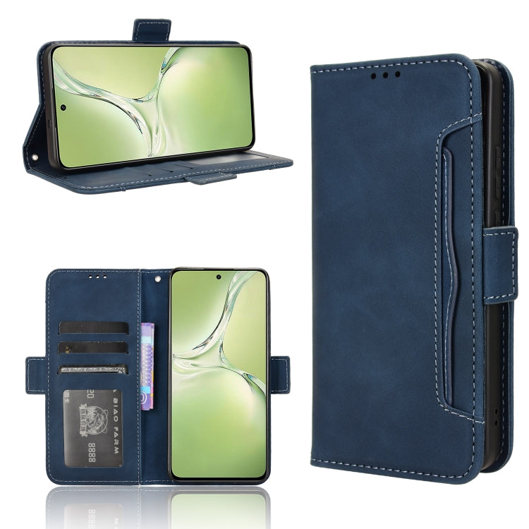 Skin Feel Calf Texture Card Slots Leather Phone Case, For OPPO Reno13 5G Global, For OPPO Reno13 F 4G / 5G, For OPPO Find X8, For OPPO K12X 5G / OnePlus Nord CE4 Lite 5G