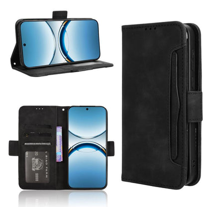 Skin Feel Calf Texture Card Slots Leather Phone Case, For OPPO Reno13 5G Global, For OPPO Reno13 F 4G / 5G, For OPPO Find X8, For OPPO K12X 5G / OnePlus Nord CE4 Lite 5G