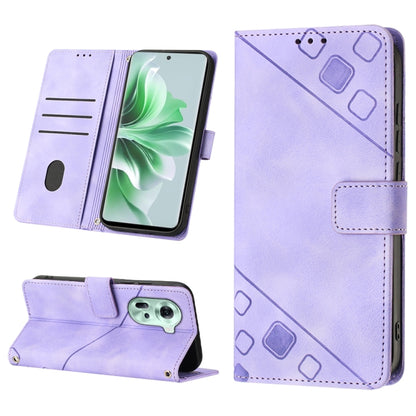 Skin-feel Embossed Leather Phone Case, For OPPO Find X7, For OPPO Reno11 5G Global, For OPPO Reno11 Pro 5G Global, For OPPO Find X7 Ultra