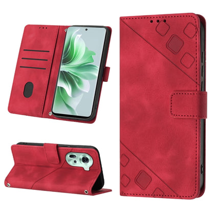 Skin-feel Embossed Leather Phone Case, For OPPO Find X7, For OPPO Reno11 5G Global, For OPPO Reno11 Pro 5G Global, For OPPO Find X7 Ultra